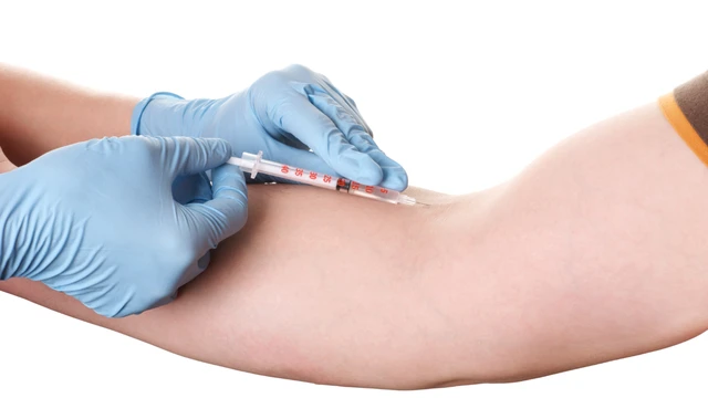 Tiêm tĩnh mạch: Lợi ích, quy trình và những lưu ý quan trọng