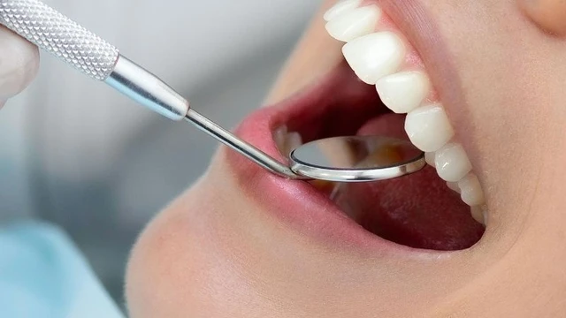 Viêm chân răng có mủ: Nguyên nhân, dấu hiệu và cách điều trị hiệu quả