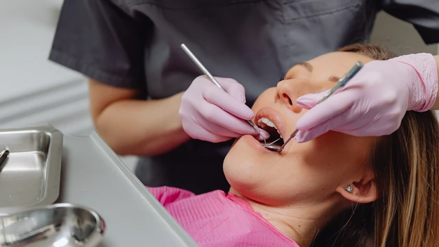 Trám răng cửa bị mẻ có đau không? Hướng dẫn chăm sóc đúng cách