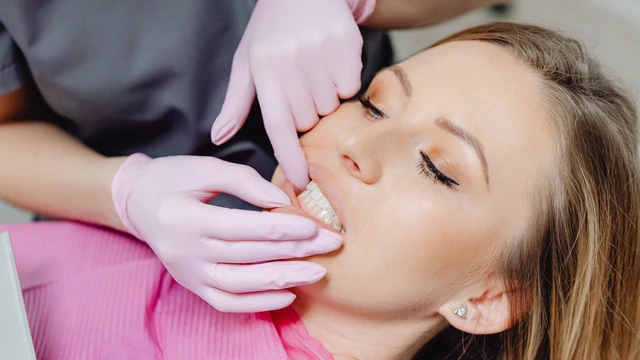 Trám răng giữ được bao lâu? Cách kéo dài tuổi thọ miếng trám
