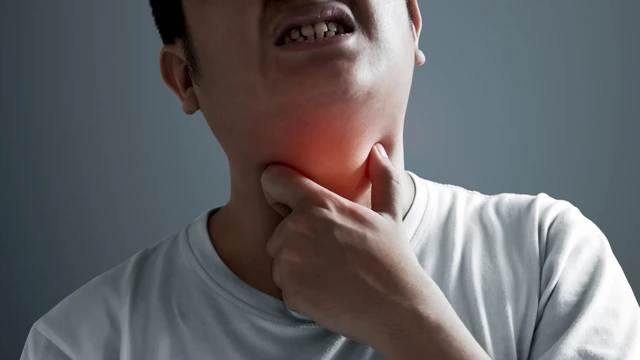 Ung thư khoang miệng sống được bao lâu? Các giai đoạn của ung thư miệng. 