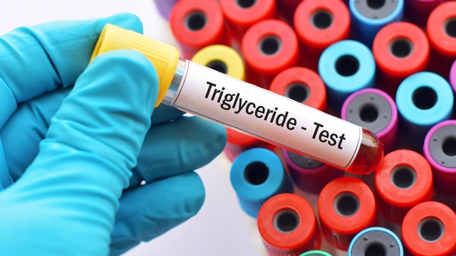 Triglyceride cao nên ăn gì? Vì sao cần điều chỉnh chế độ ăn?