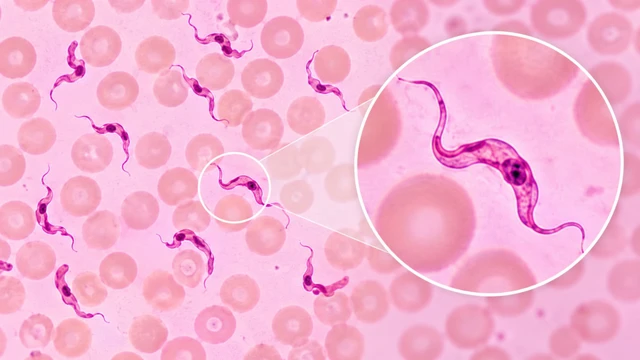 trypanosoma_la_ky_sinh_trung_gi_phan_loai_va_cach_phong_ngua_1_55a4fc86f2