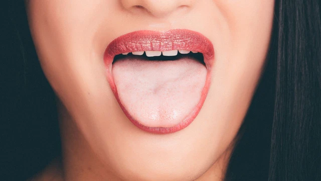 U nhú lưỡi là gì? Nguyên nhân, triệu chứng và cách điều trị