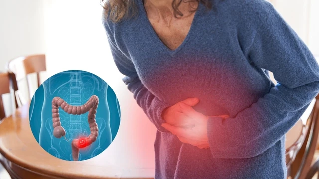 Ung thư đại tràng có chữa được không? Hướng dẫn chi tiết cho người bệnh