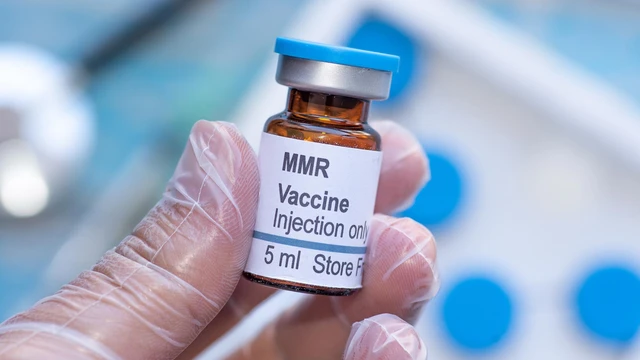 Vắc xin sởi - quai bị - Rubella cho người lớn và những điều cần biết