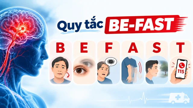 van_thay_binh_thuong_lieu_co_the_dang_dot_quy_nhan_biet_som_bang_quy_tac_be_fast_1_187841e7fb