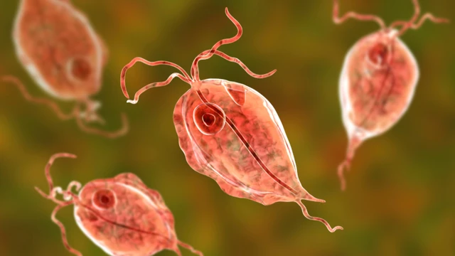 Viêm âm đạo do Trichomonas: Nguyên nhân, triệu chứng và cách điều trị