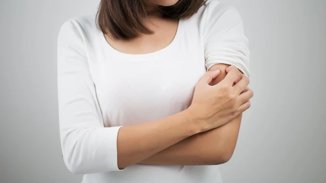 Viêm da tiếp xúc là gì? Nguyên nhân, cách điều trị và phòng ngừa
