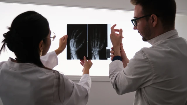 Viêm khớp dạng thấp có chữa khỏi được không? Các yếu tố hỗ trợ quan trọng ngoài thuốc