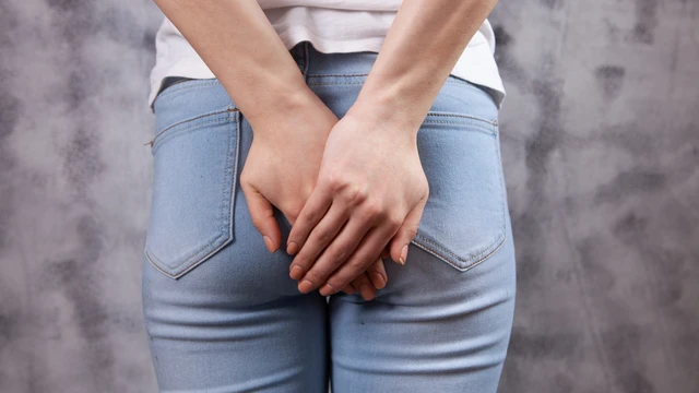 Viêm nang lông ở mông​ là gì? Cách ngăn ngừa viêm nang lông