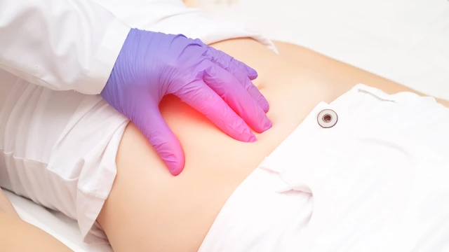 Viêm phúc mạc là gì? Triệu chứng, nguyên nhân, chẩn đoán và cách điều trị