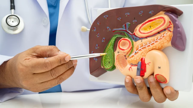 Viêm túi mật có phải mổ không? Chỉ định cụ thể và an toàn