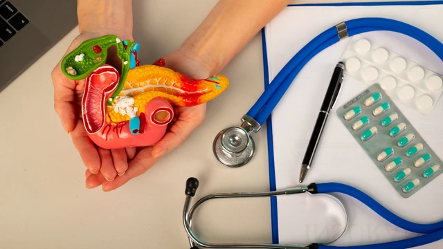 Viêm tụy cấp là gì? Nguyên nhân, triệu chứng, chẩn đoán và điều trị