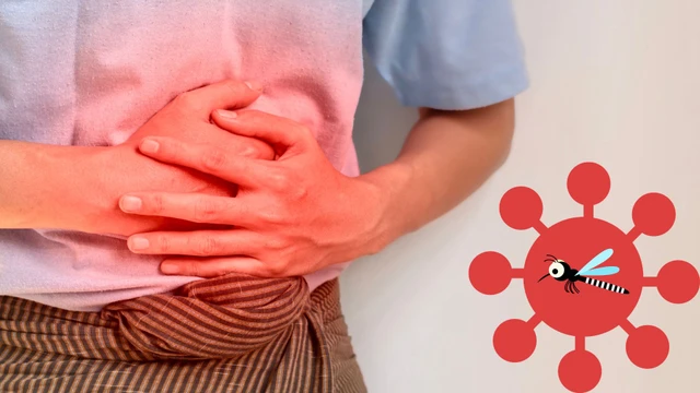 Viêm tụy cấp do sốt xuất huyết: Triệu chứng, biến chứng và cách điều trị