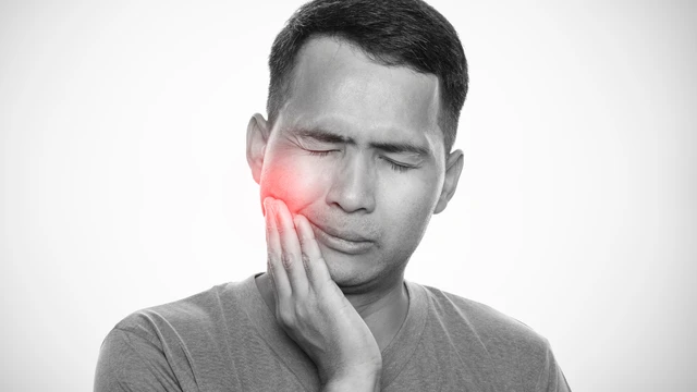 Viêm tủy răng có mủ​: Nguyên nhân, dấu hiệu nhận biết và cách điều trị