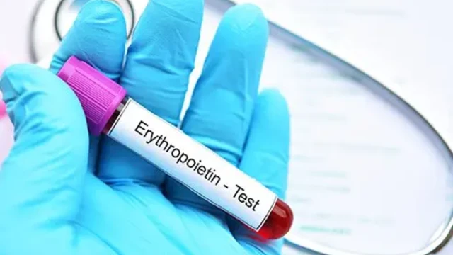 Xét nghiệm Erythropoietin là gì? Ý nghĩa kết quả xét nghiệm Erythropoietin 