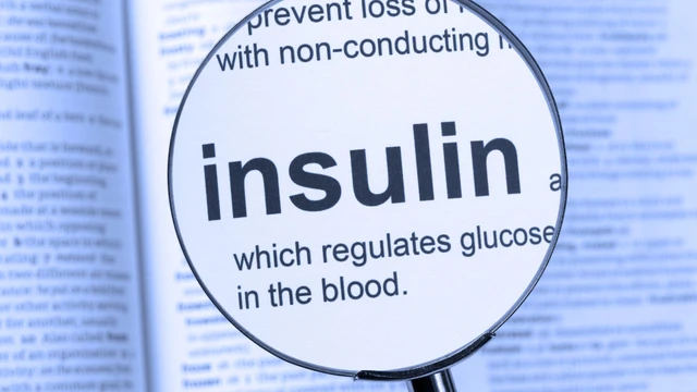 Xét nghiệm insulin là gì? Khi nào cần làm và cách đọc kết quả chính xác