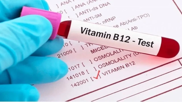 Xét nghiệm vitamin B12 là gì? Khi nào cần thực hiện?