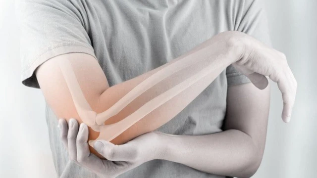 Xương cánh tay là gì? Vị trí, cấu tạo, chức năng và bệnh lý liên quan
