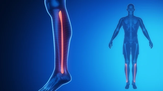 Xương mác là gì? Vị trí, cấu tạo, chức năng và các vấn đề liên quan