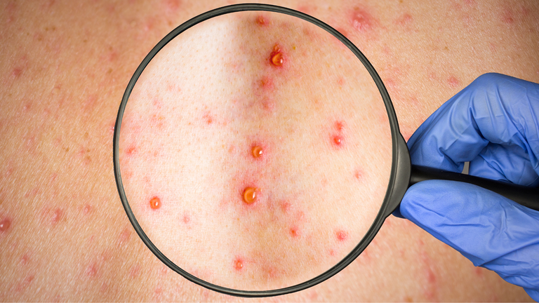 4. Thực phẩm nên bổ sung để hỗ trợ hồi phục bỏng dạ