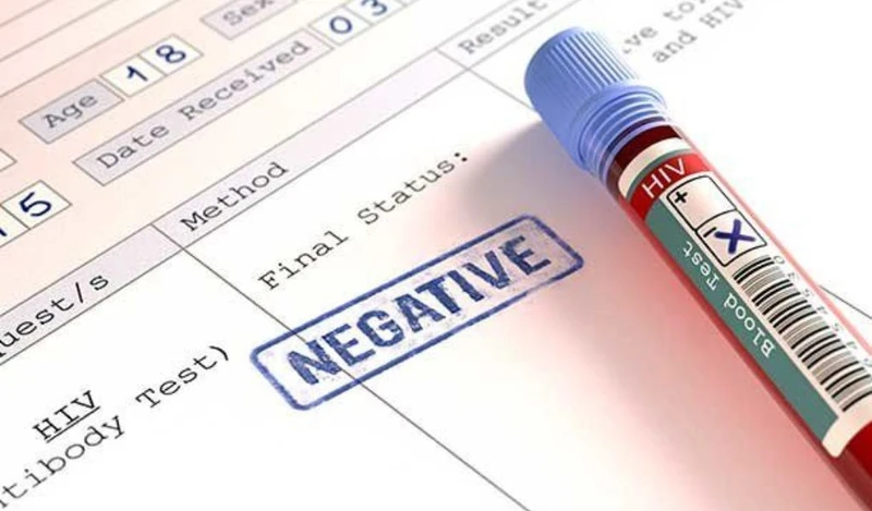Cách đọc kết quả xét nghiệm HIV dễ dàng và chính xác 1