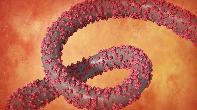 Sốt xuất huyết Ebola là gì? Nguyên nhân, triệu chứng và cách phòng ngừa 1