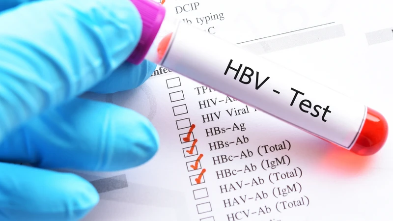 Xét nghiệm HBV là gì là câu hỏi được nhiều người quan tâm
