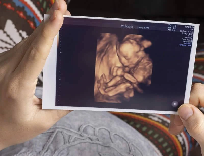 22 tuần là mấy tháng? Sự phát triển của thai nhi 22 tuần tuổi mẹ cần biết 2