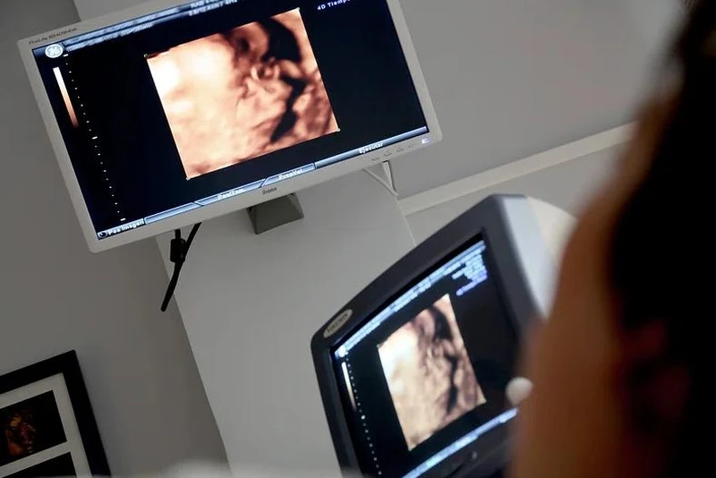 27 tuần là mấy tháng? Gợi ý cách chăm sóc mẹ bầu 27 tuần 2