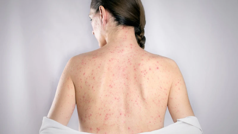 benh-rubella-o-phu-nu-mang-thai 2.png