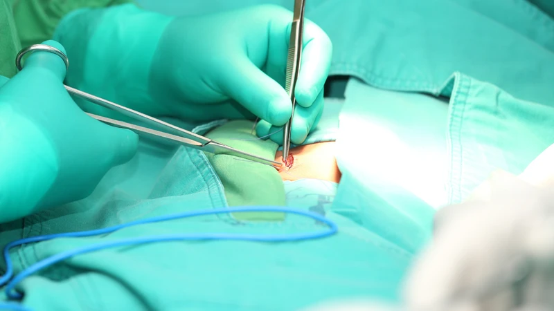 Bác sĩ thường chỉ định phẫu thuật ở người xác định bị thoát vị bẹn