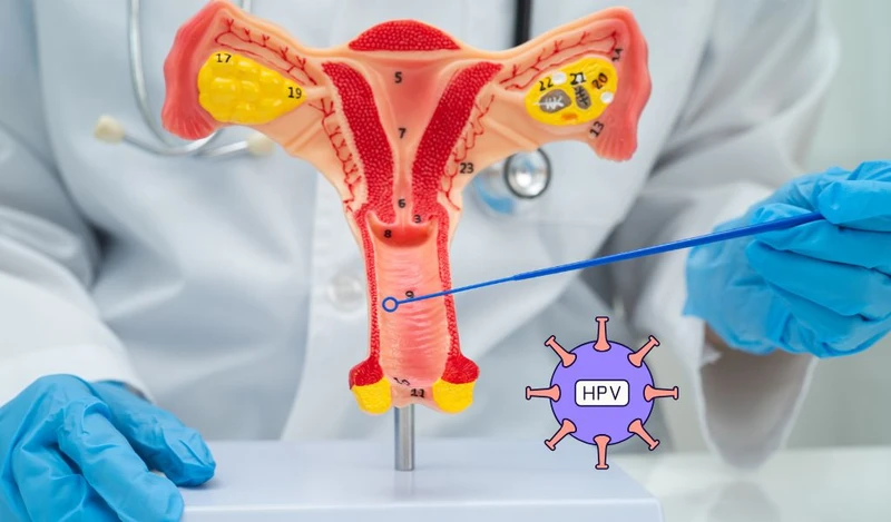 HPV có chữa được không? HPV chưa thể chữa khỏi hoàn toàn nhưng có thể kiểm soát tốt
