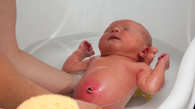 Hãy đưa bé đi khám nếu rốn có biểu hiện sưng đỏ