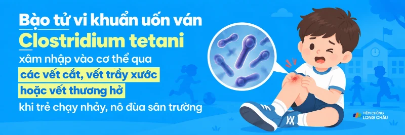 Vết thương hở có thể tạo điều kiện cho bào tử uốn ván xâm nhập