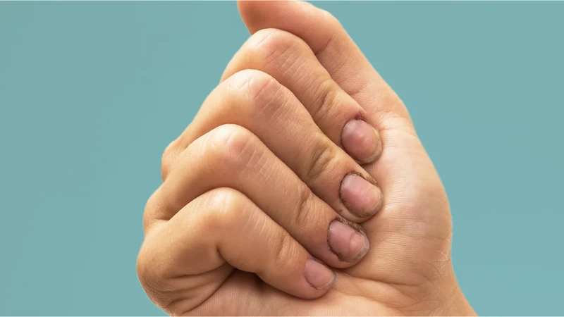 Tiêu chảy cấp: Nguyên nhân, triệu chứng, điều trị và cách phòng ngừa tiêu chảy cấp 4.png