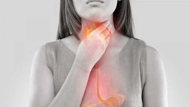 U nhú thực quản là gì? Nguyên nhân, triệu chứng, điều trị và phòng ngừa u nhú thực quản 4.png