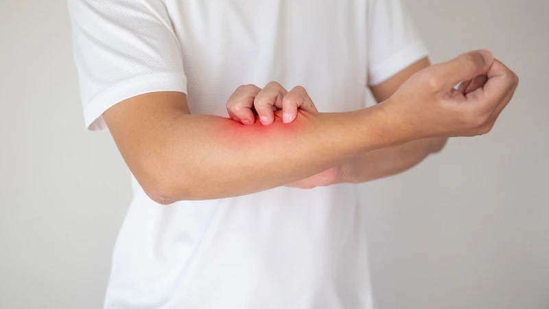 Không nên gãi hay làm vỡ bóng nước
