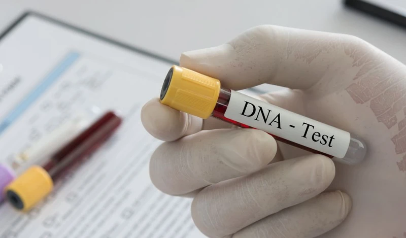 Xét nghiệm HPV DNA là một trong những bước sàng lọc quan trọng nhất để phân loại nguy cơ