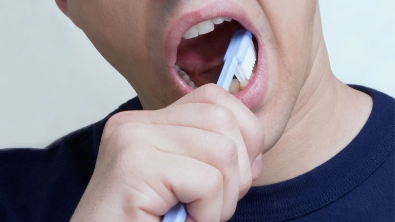 U nhú amidan là gì? Nguyên nhân, triệu chứng, điều trị và cách phòng ngừa u nhú amidan 4.png