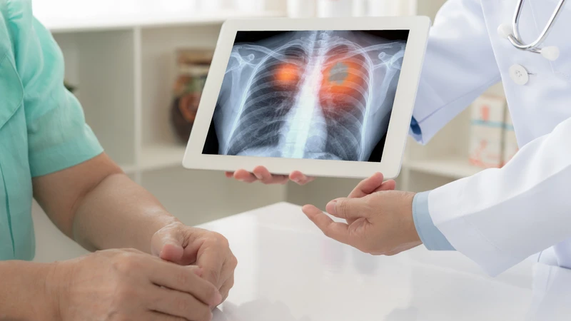 Duy trì các thói quen tốt mỗi ngày cũng góp phần bảo vệ chức năng hô hấp