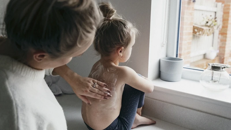 Thuỷ đậu bội nhiễm là gì? Nguyên nhân, dấu hiệu nhận biết và các phương pháp điều trị thuỷ đậu bội nhiễm 6.png