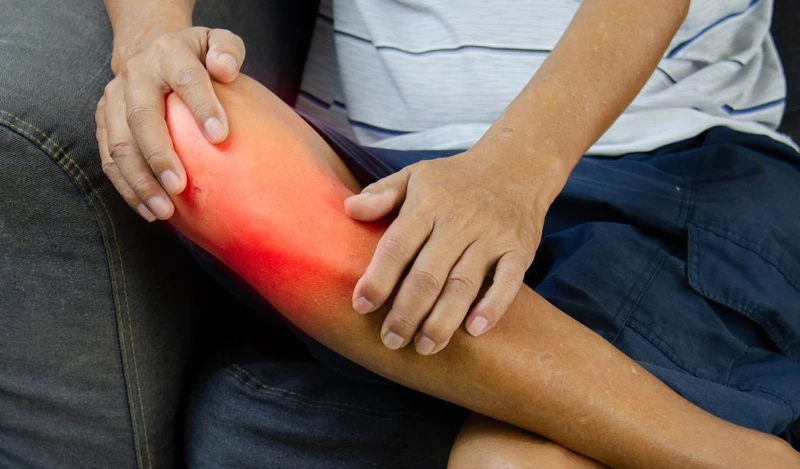 Đau khớp gối, sưng quanh khớp là dấu hiệu thường gặp khi khớp gối bị tổn thương
