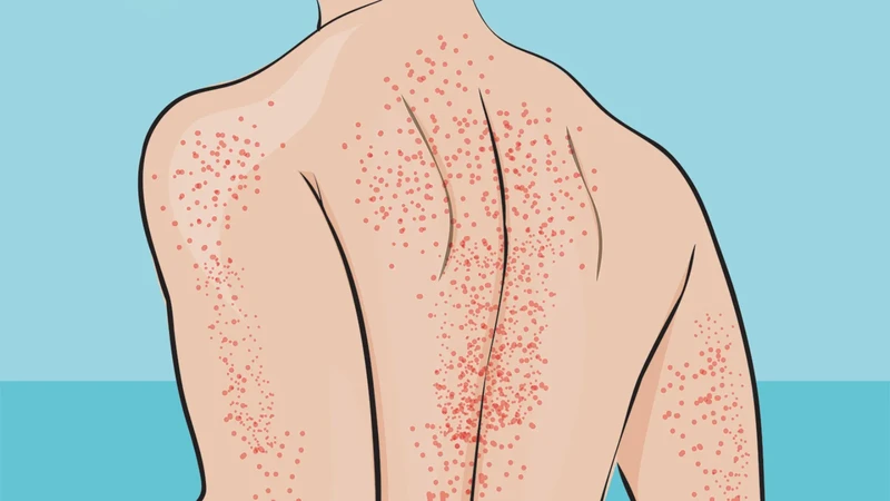 Xuất huyết dưới da: Nguyên nhân, triệu chứng, xử trí và phòng ngừa 7.png