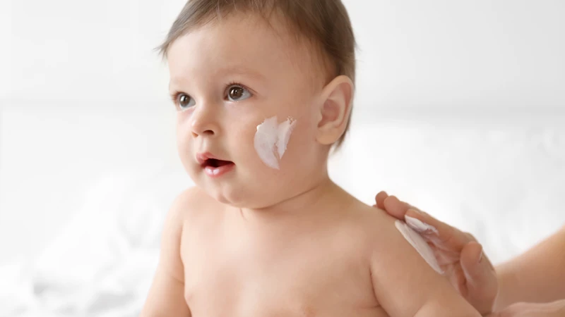 Nổi mề đay ở trẻ em kiêng gì và nên ăn gì để giảm mẩn ngứa 4.png