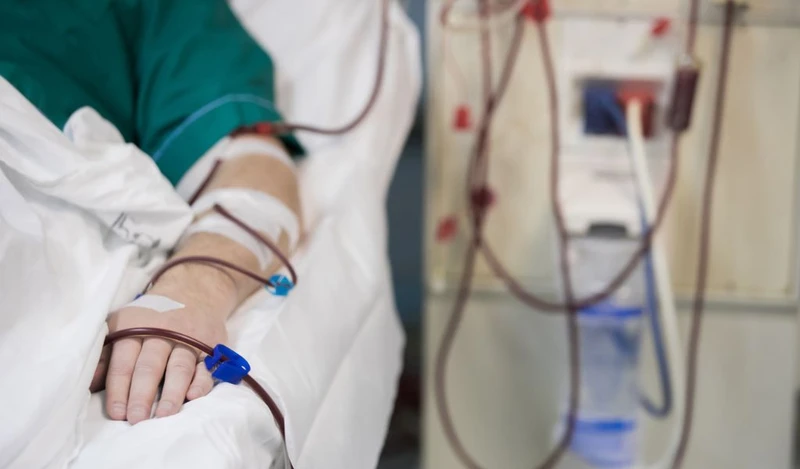 Suy thận cấp là biến chứng nghiêm trọng do tiêu cơ vân gây ra