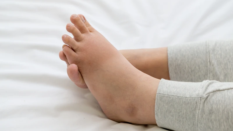 Trẻ bị tim bẩm sinh sống được bao lâu Làm thế nào để chăm sóc trẻ đúng cách 2.png