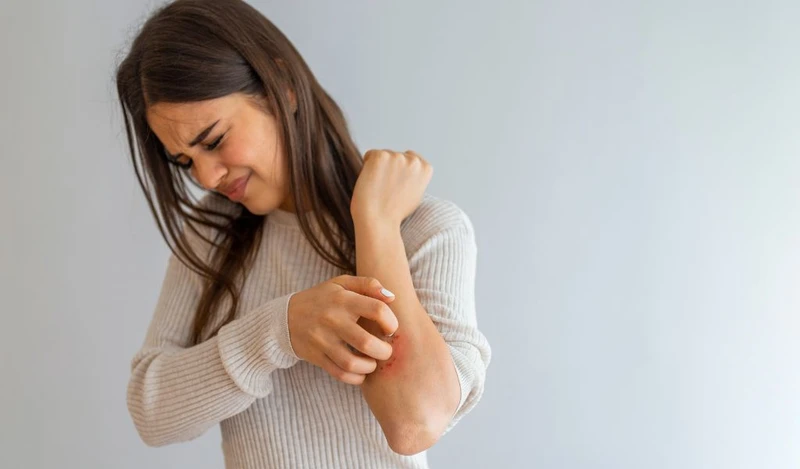 “Bệnh vảy nến có tự hết không?” là điều khiến nhiều người băn khoăn