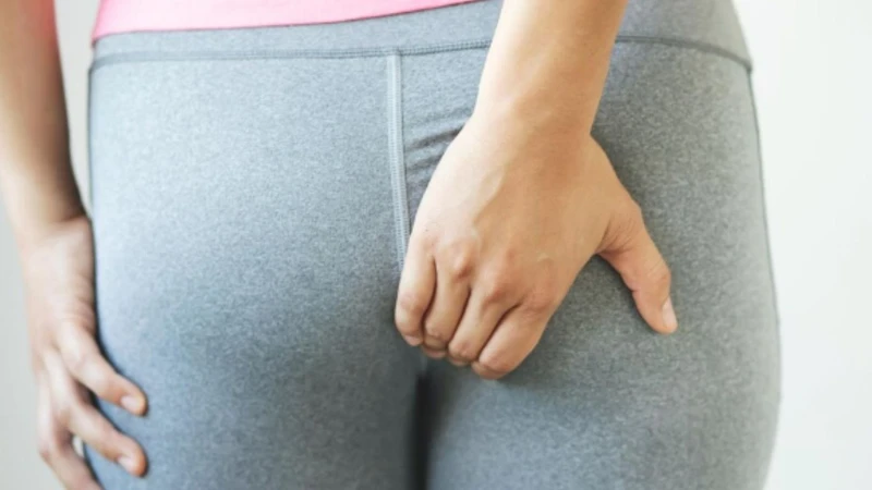 Hắc lào ở mông​ có tự khỏi được không? 1